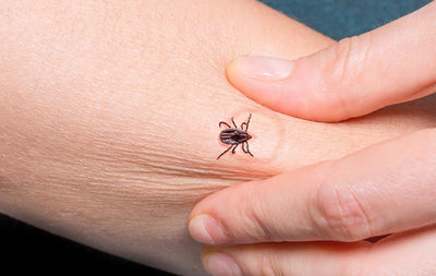 Tick Bite Prevention: 7 Ways to Protect Yourself in the Backyard or Wilderness
